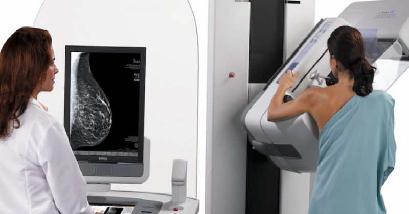 Mammary gland molybdenum target inspection